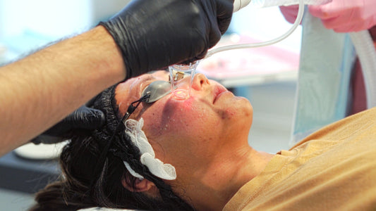 CO2 Laser