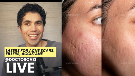 Lasers for Acne Scars