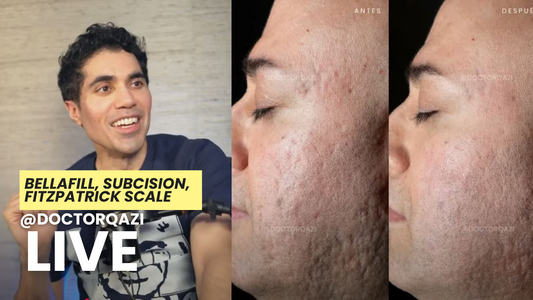 subcision