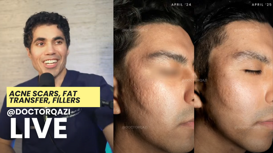 fat transfer