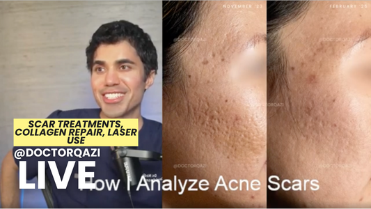 laser