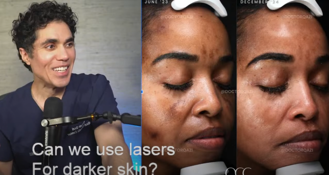 lasers for dark skin