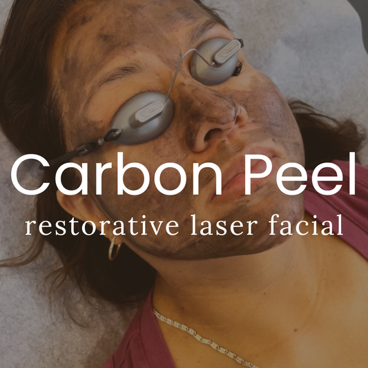 Carbon Laser Facial