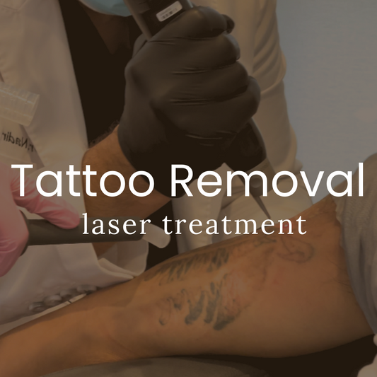 Laser Tattoo Removal (Qazi Academy)