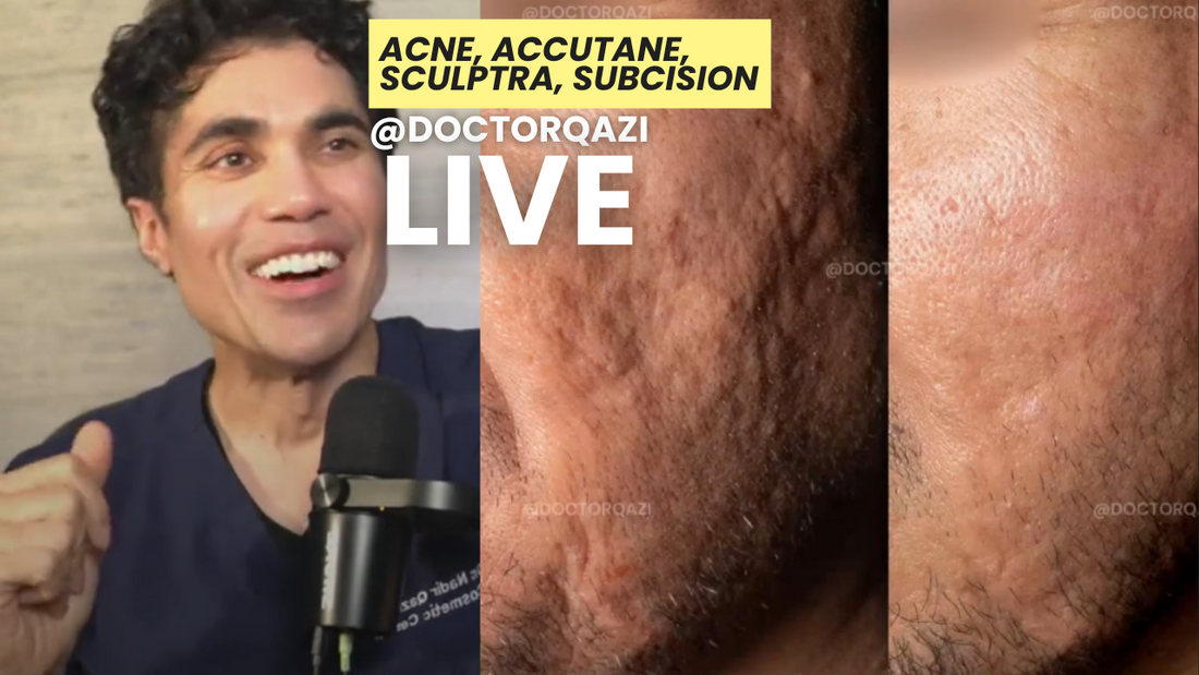 Subcision