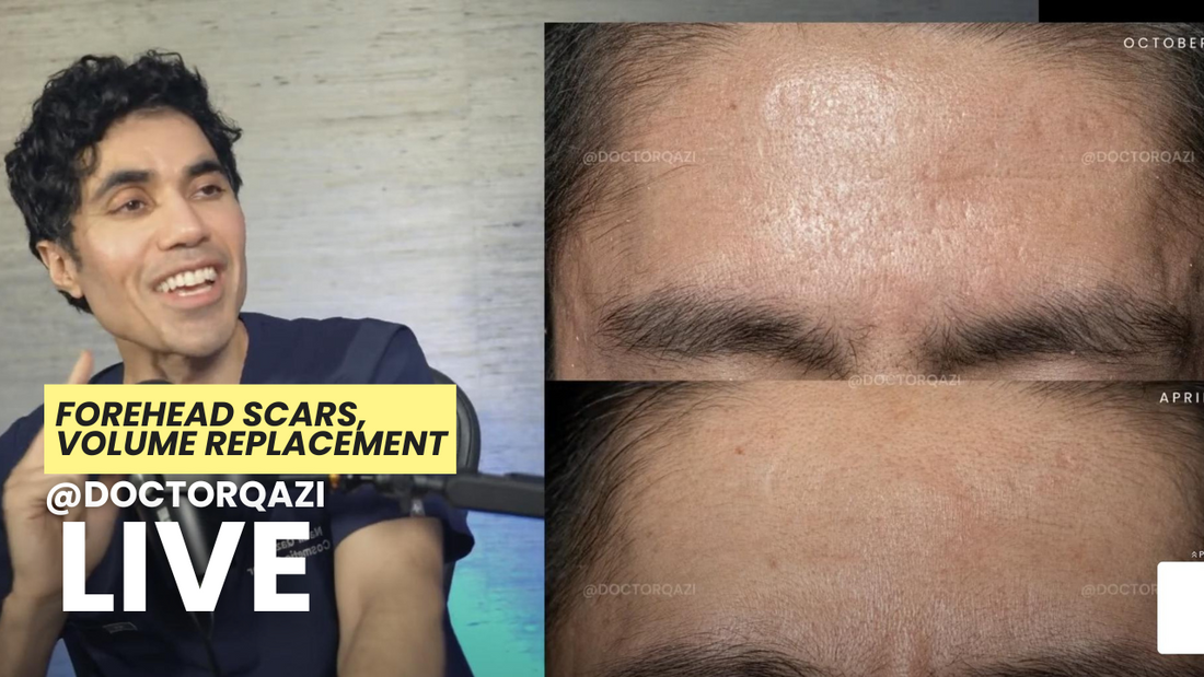 Forehead Scars