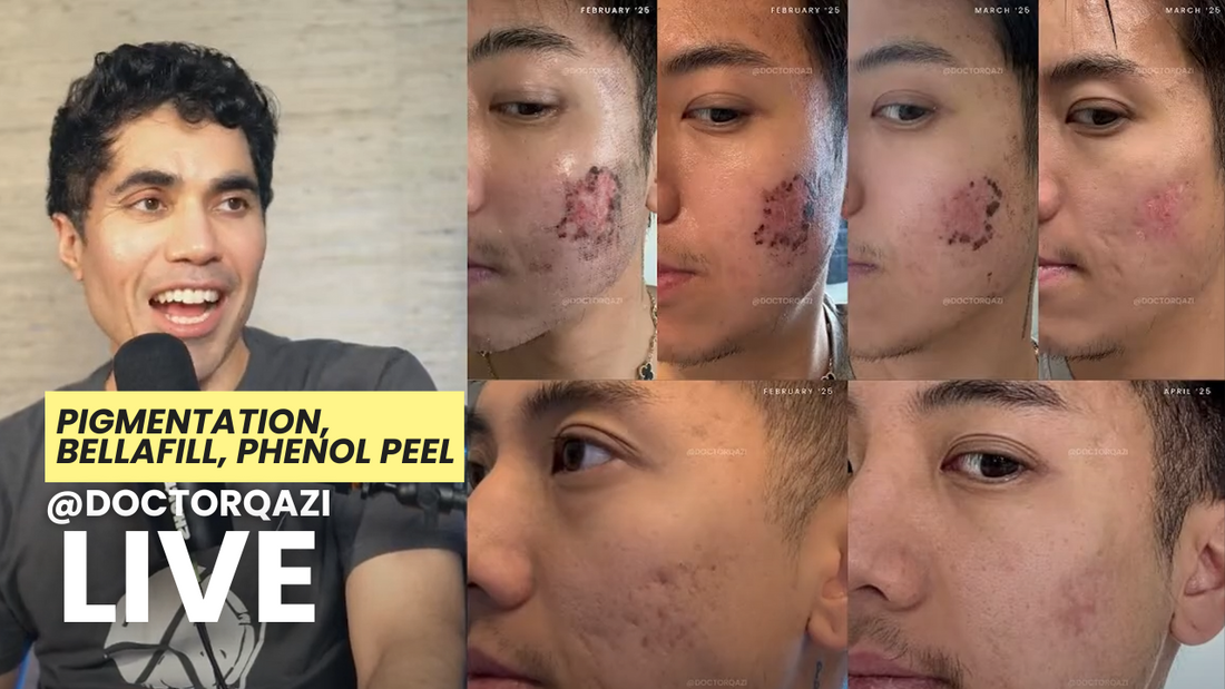 Pigmentation