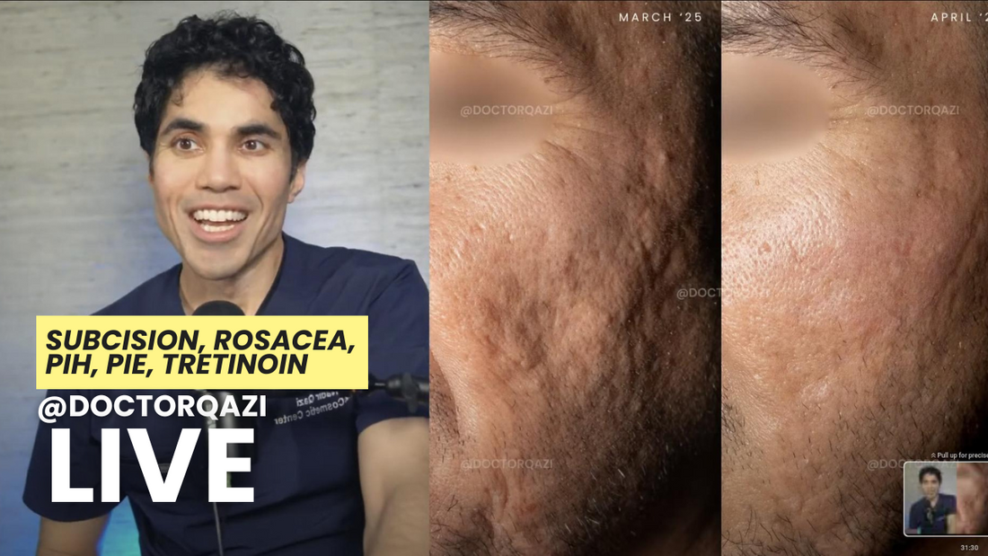 Sculptra