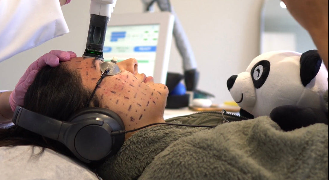 Accure Laser