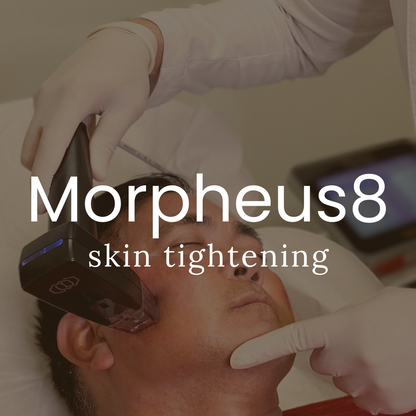 Morpheus8 Skin Tightening or Fat Reduction