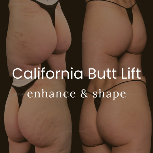 California Butt Lift - Special