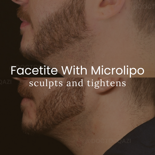 Facetite with Micro Liposuction