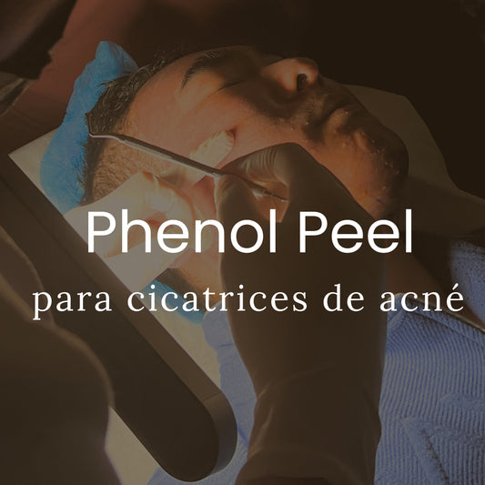 Phenol Peel de 2 Pasos para Cicatrices de Acné