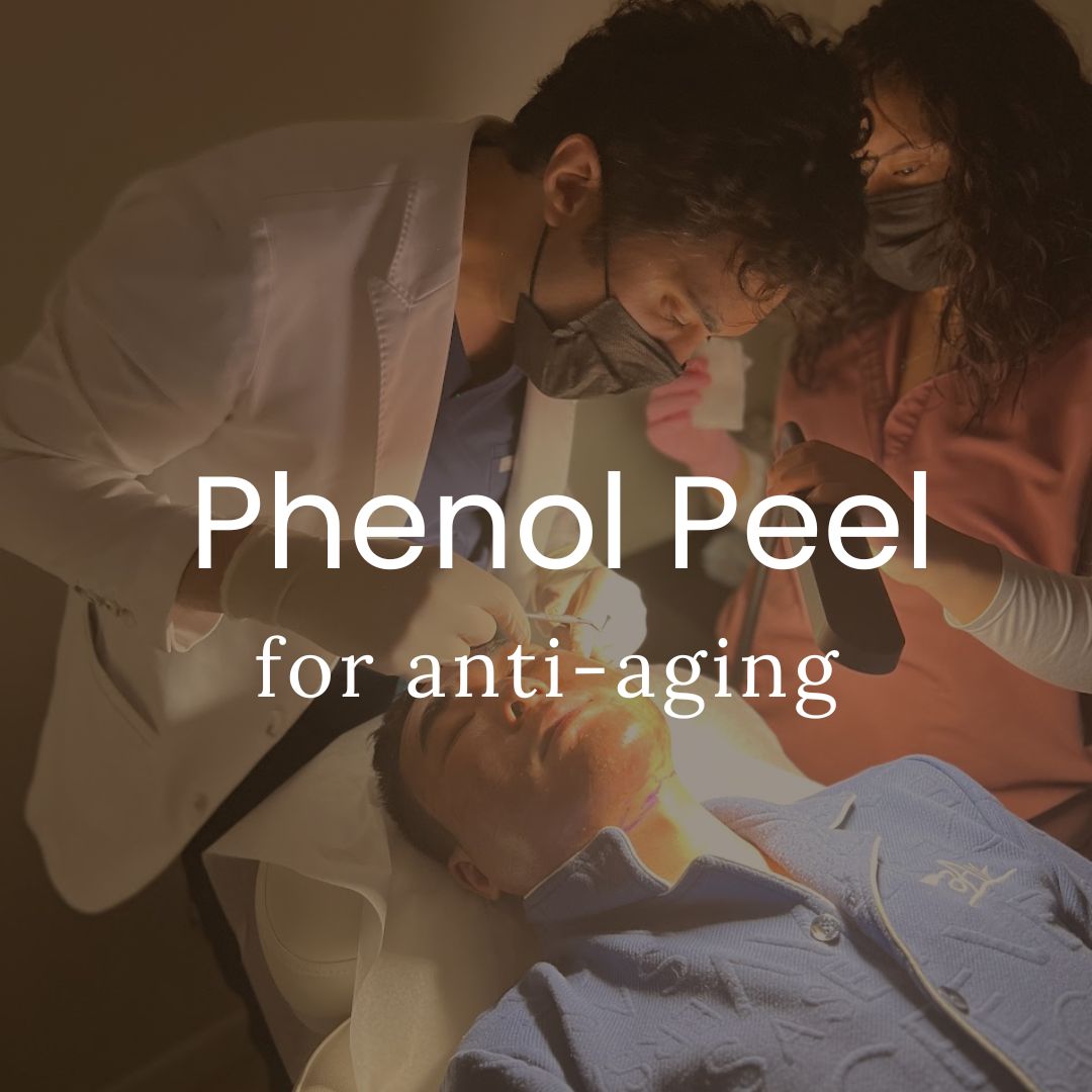 Phenol Peel for Anti-Aging (Deep Lines and Wrinkles)