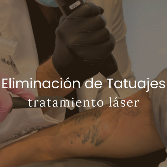 Academia Qazi - Eliminación de Tatuajes - X-Grande (manga completa o espalda)