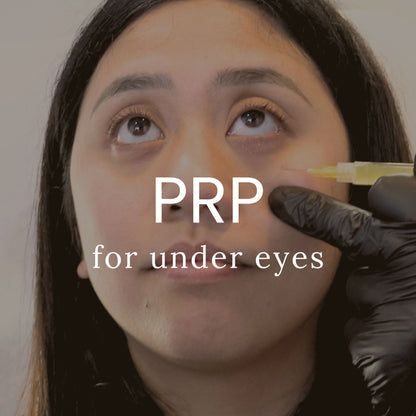 PRP for Undereyes - Sapphire Pricing