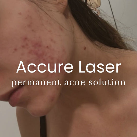 🎁 Accure Acne Laser Treatment (100% off)