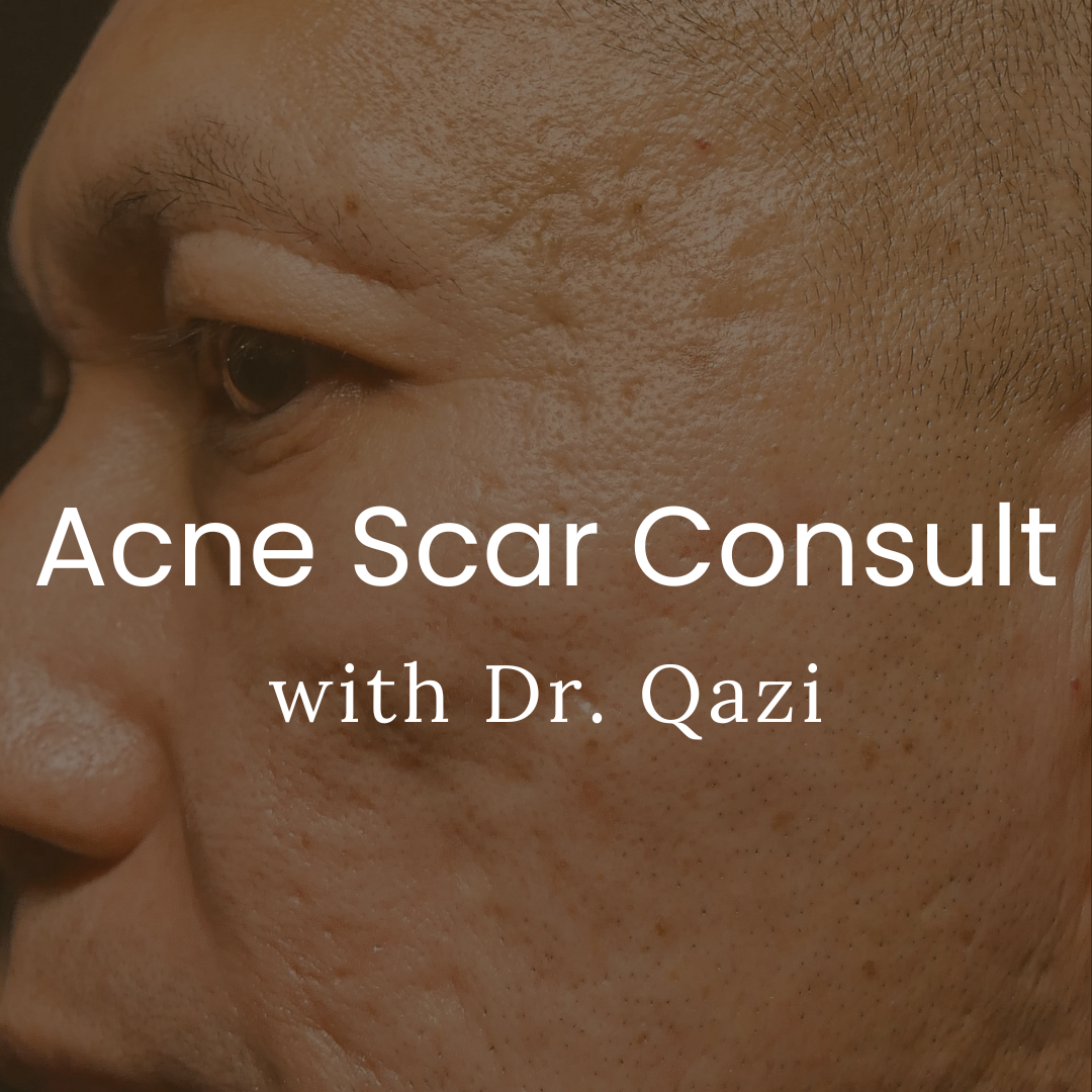 Acne Scar Consultation Qazi Cosmetic Center