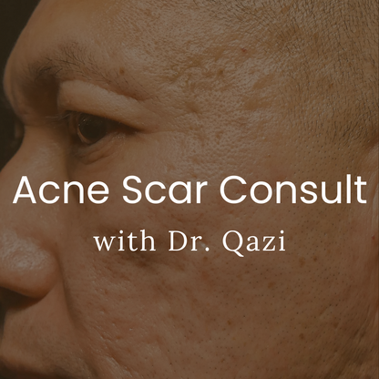 Acne Scar Consultation with Dr. Qazi