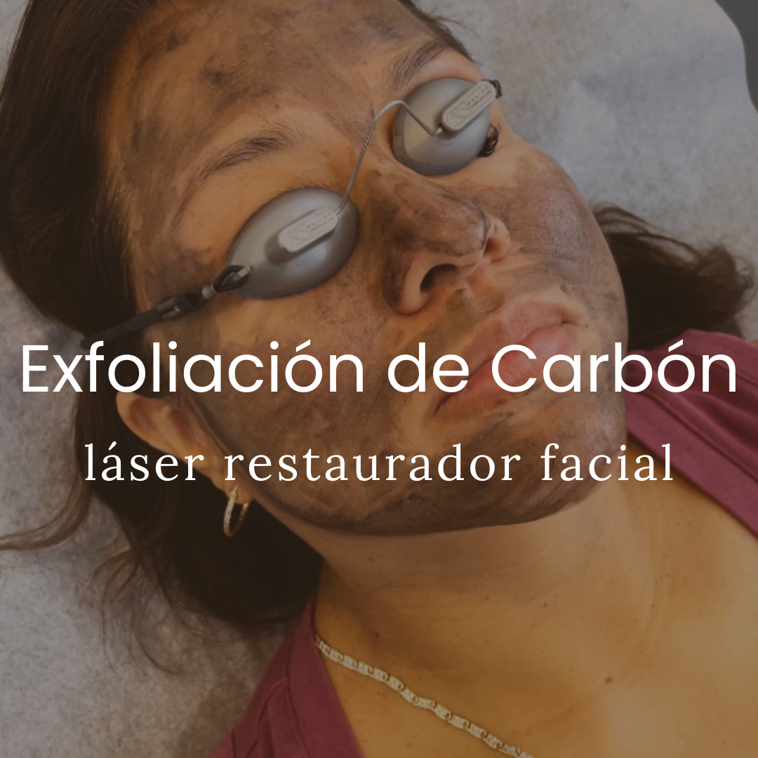 Exfoliación Facial Con Láser De Carbono
