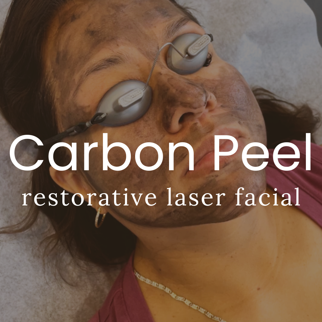 Qazi Academy - Hollywood Facial (Carbon Peel Laser)