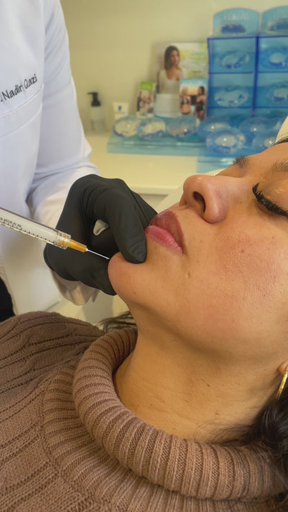 Chin Enhancement Filler Treatment