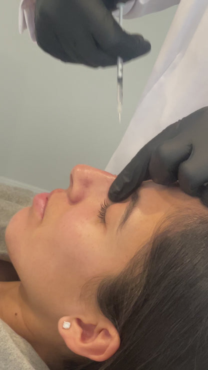 Nose Filler Profile Refinement