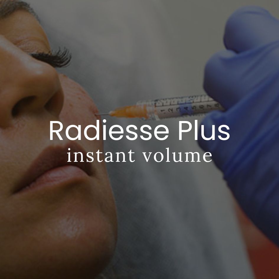 Radiesse Biostimulating Calcium Filler