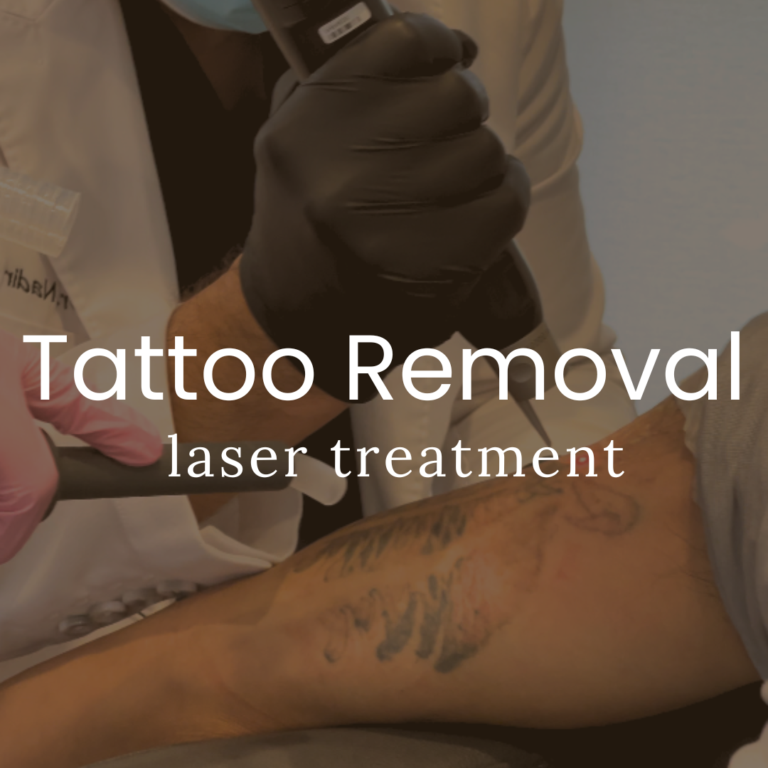 Qazi Academy - Laser Tattoo Removal