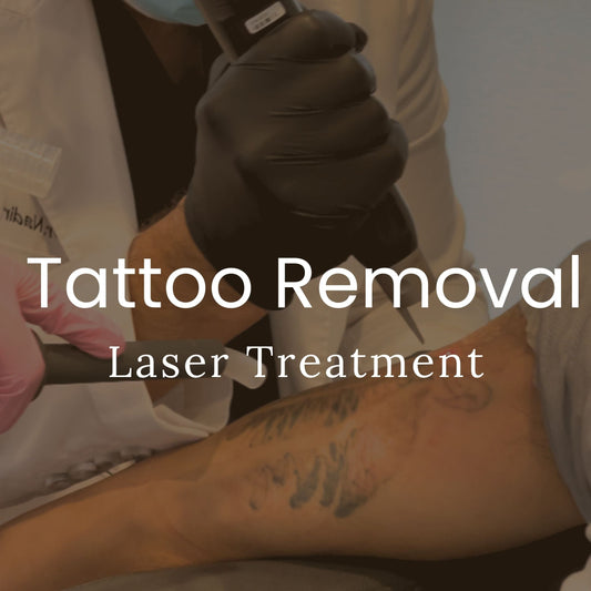 Qazi Academy - Laser Tattoo Removal