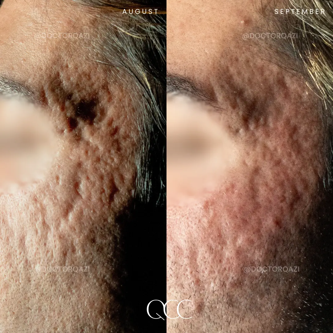 gallery.image.item,102