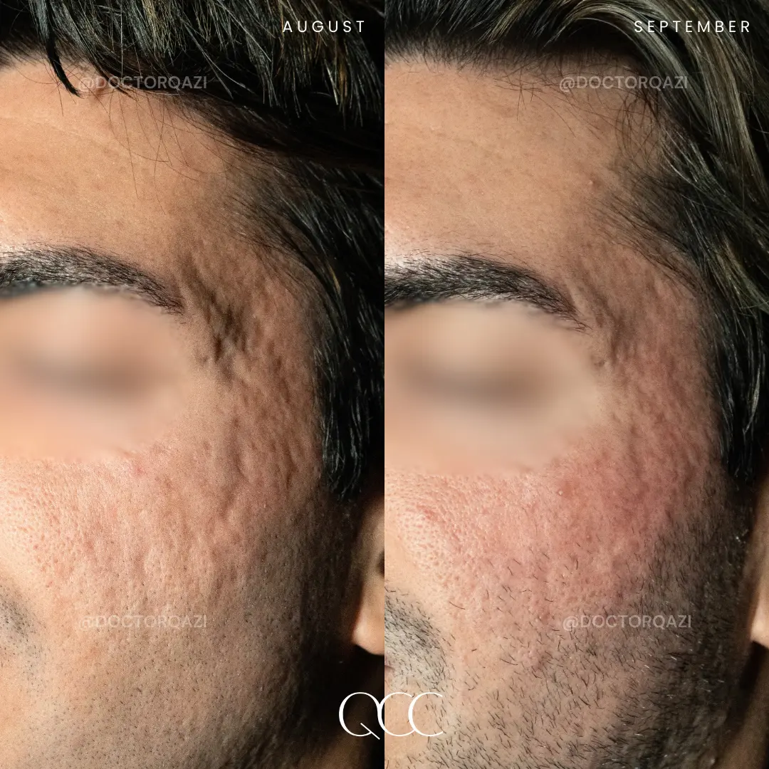 gallery.image.item,103