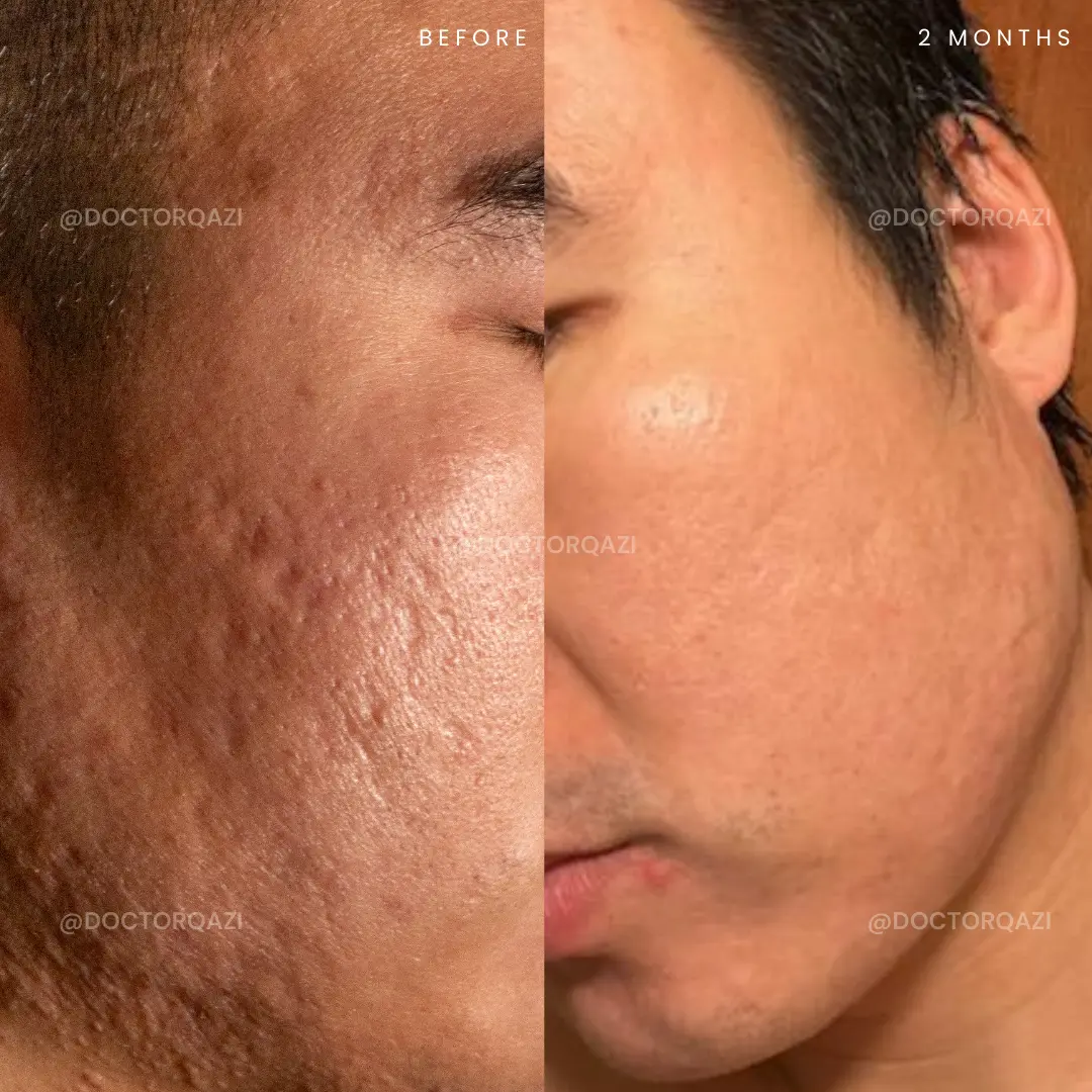 gallery.image.item,105