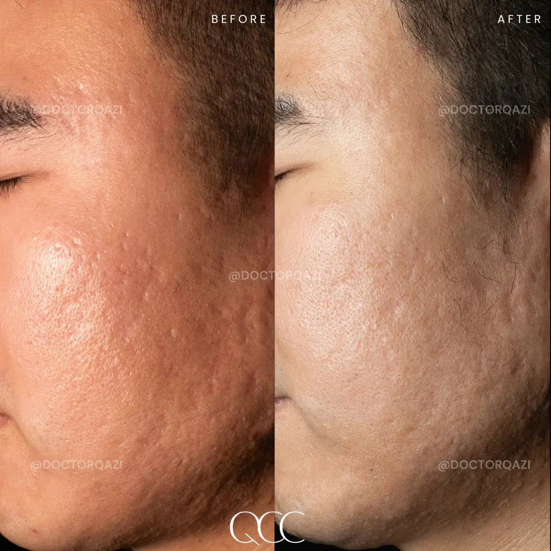 gallery.image.item,106