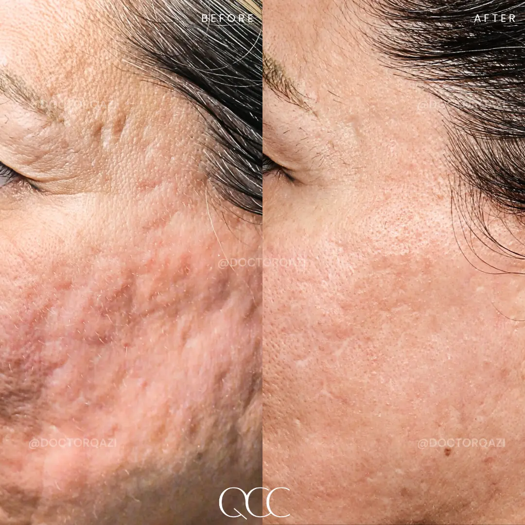 gallery.image.item,108