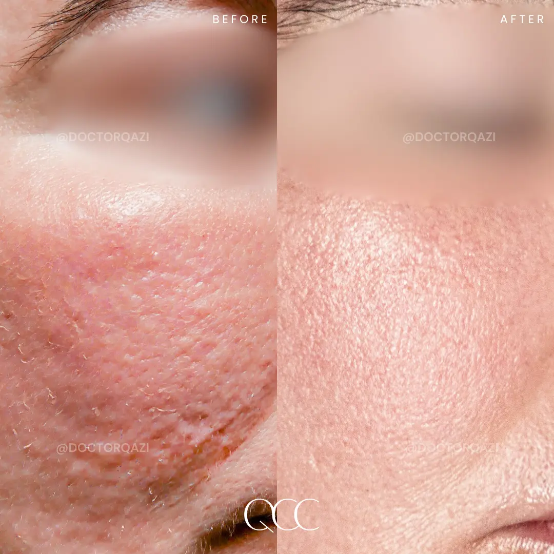 gallery.image.item,109