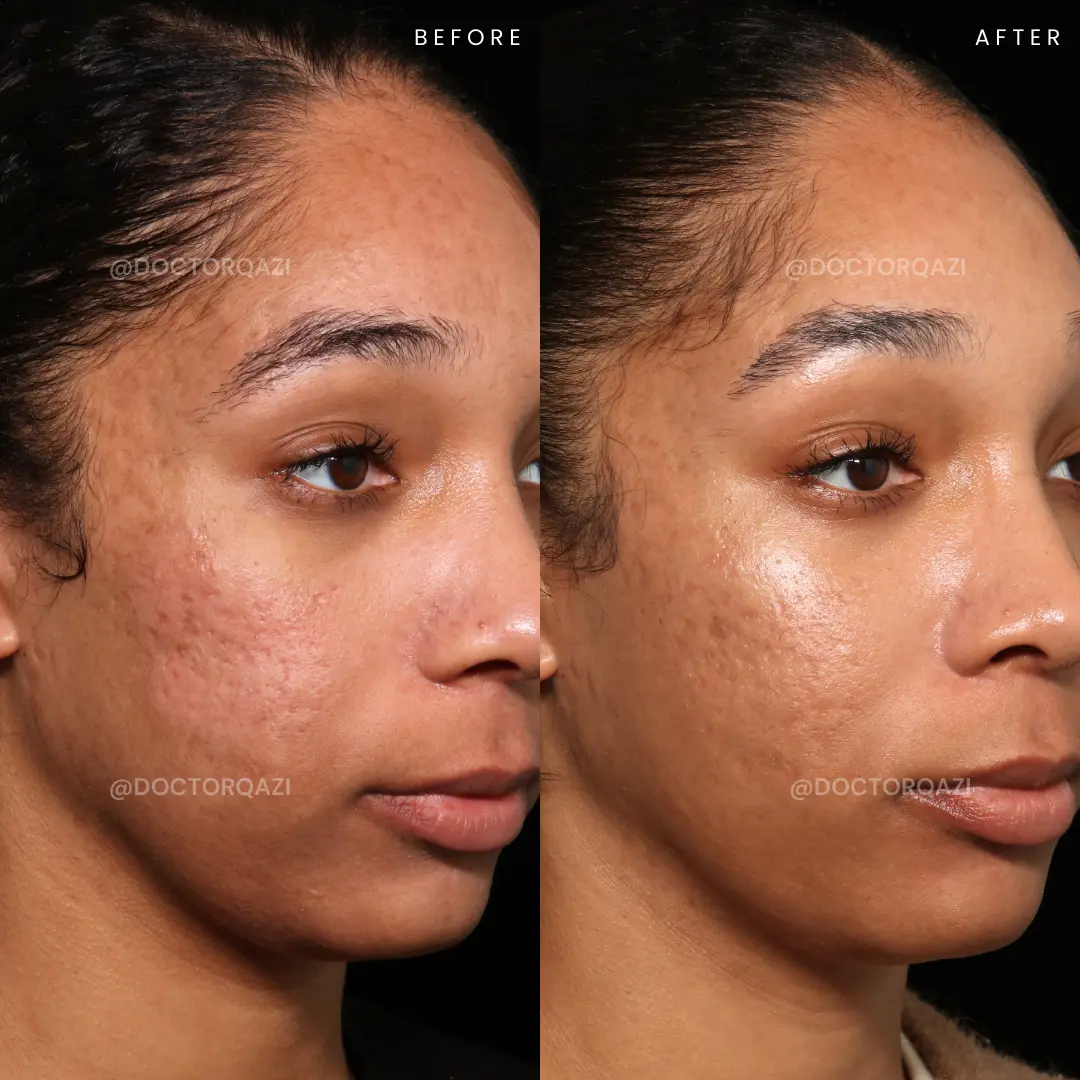 gallery.image.item,110