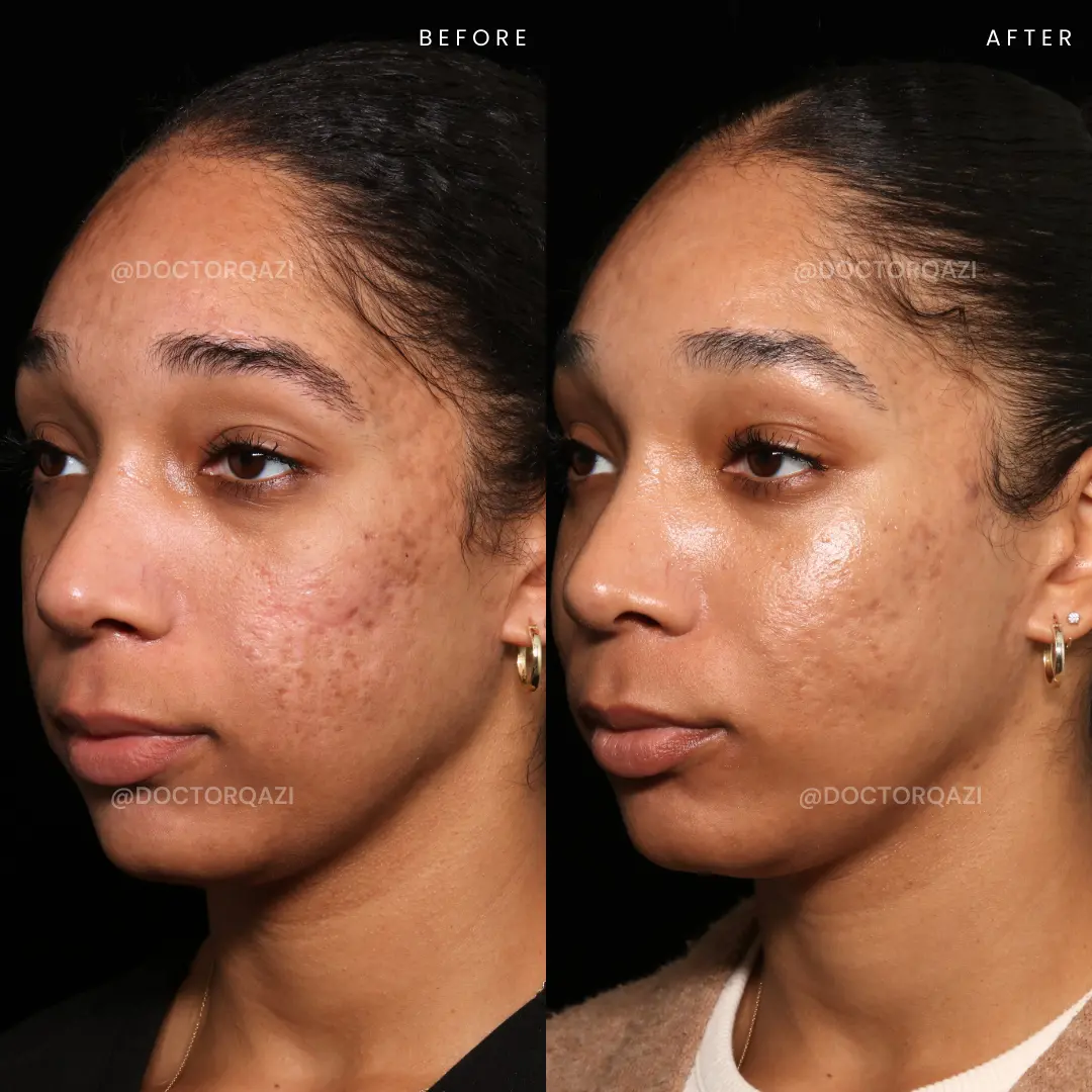 gallery.image.item,111