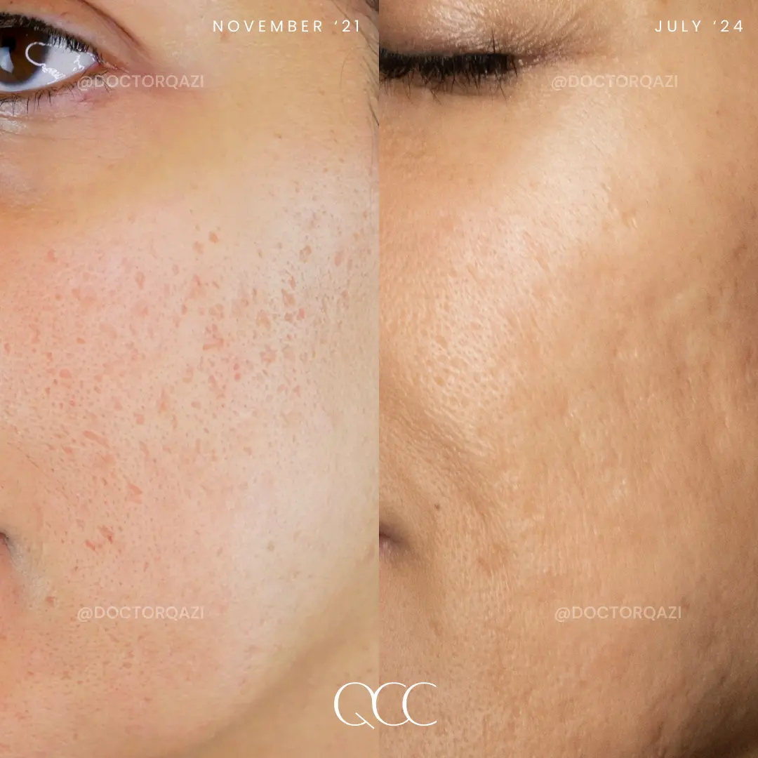 gallery.image.item,112