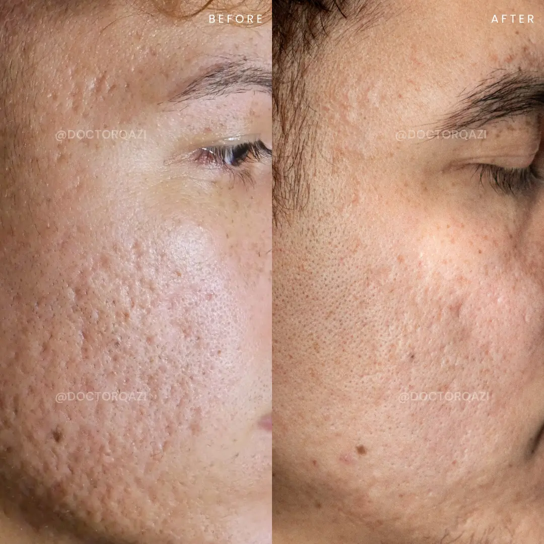 gallery.image.item,113