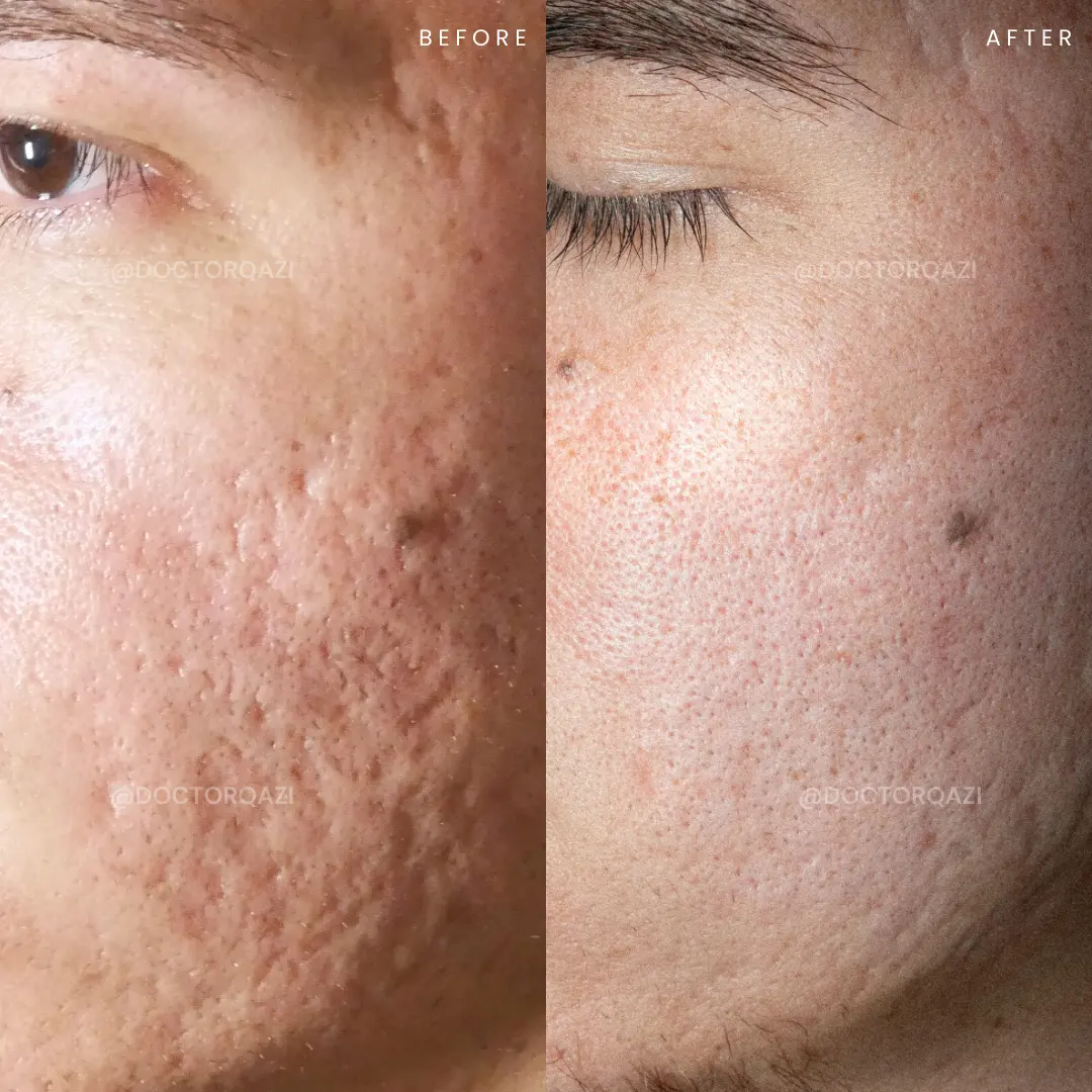 gallery.image.item,114