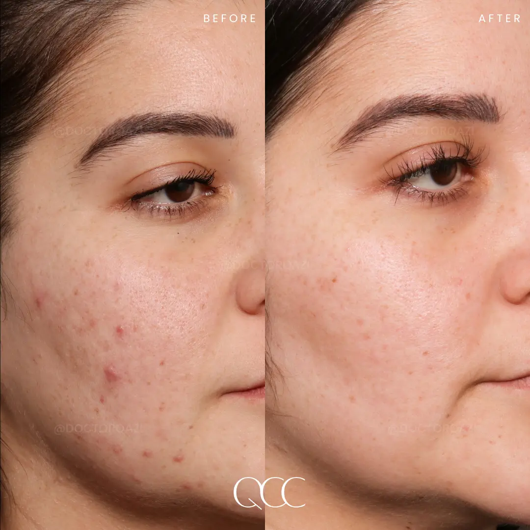 gallery.image.item,115