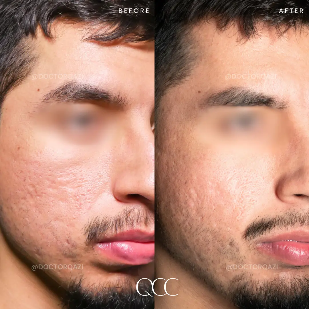 gallery.image.item,116