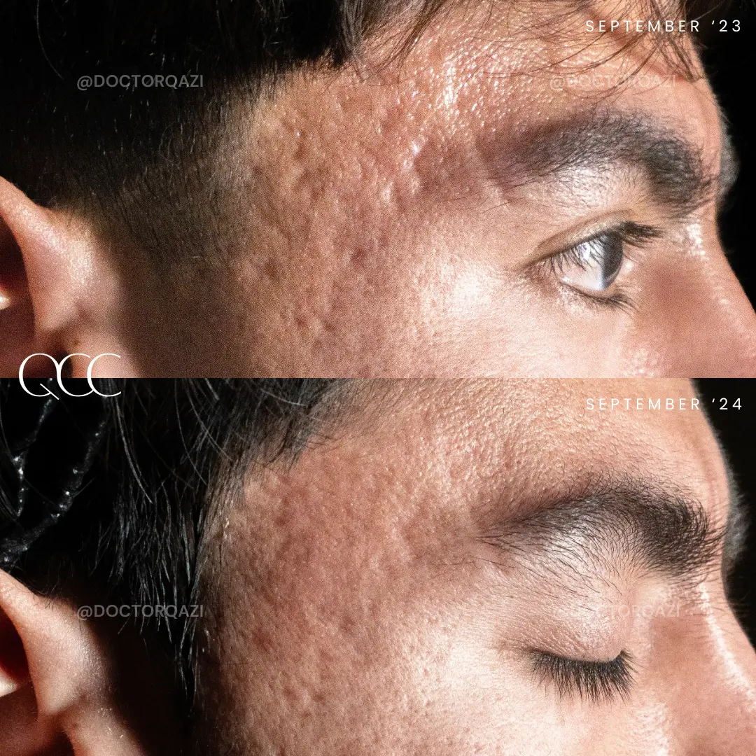 gallery.image.item,117