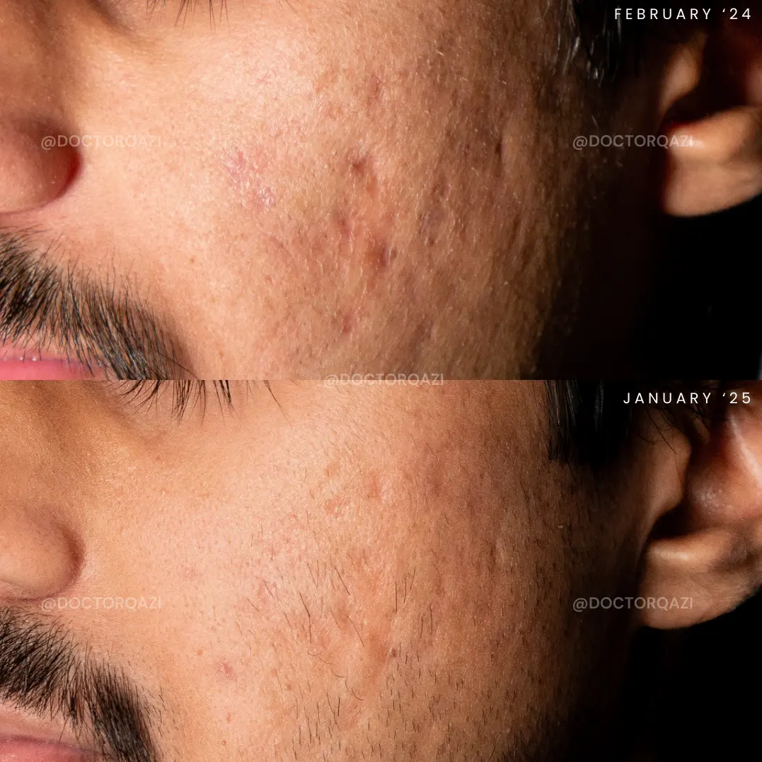 gallery.image.item,118