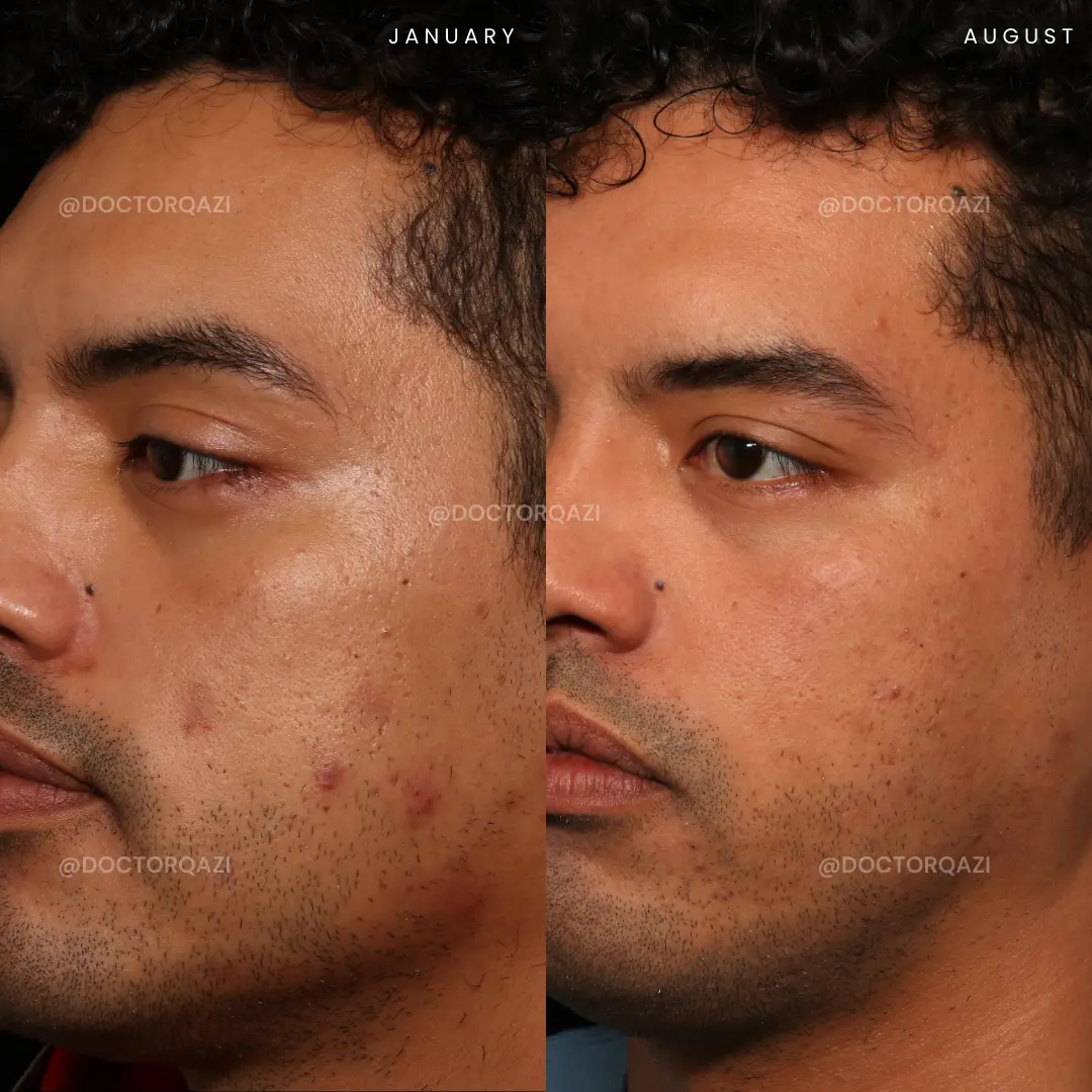 gallery.image.item,12