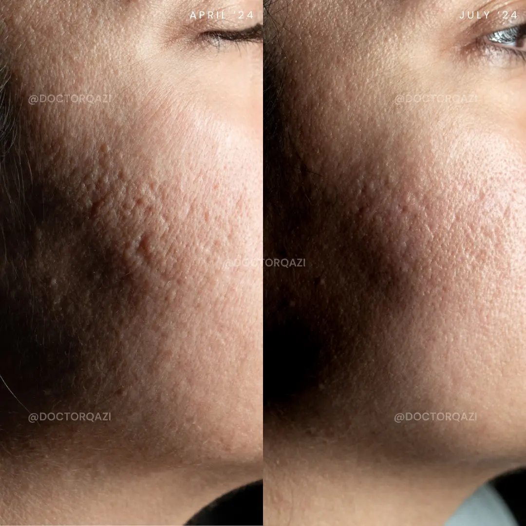 gallery.image.item,121