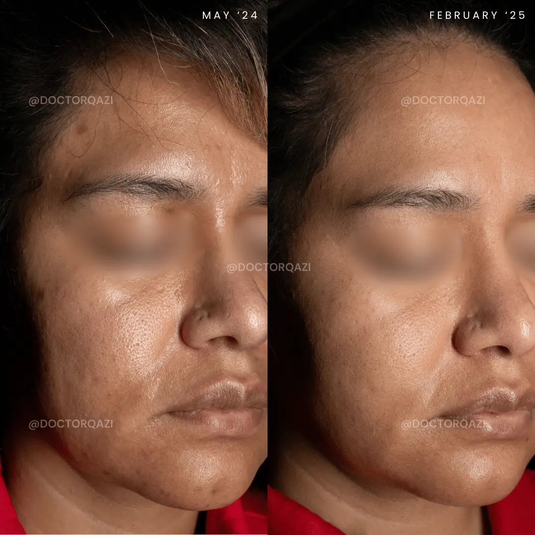 gallery.image.item,17