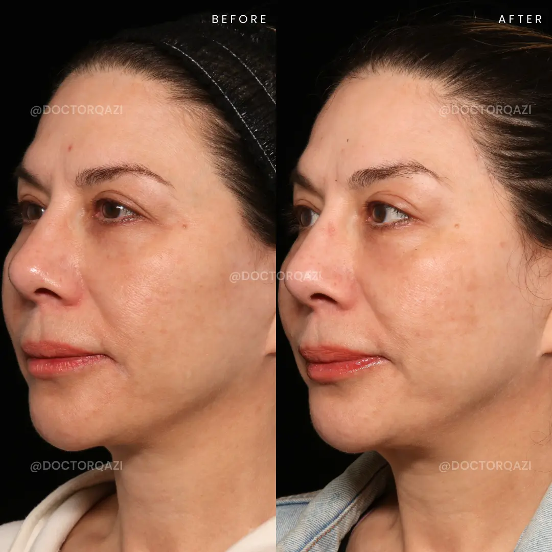 gallery.image.item,21