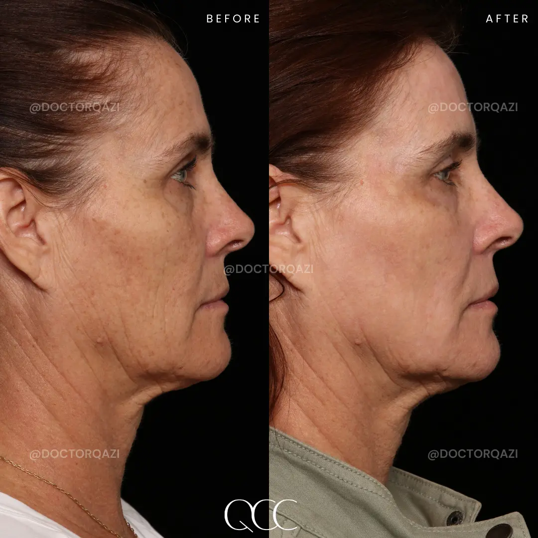 gallery.image.item,22